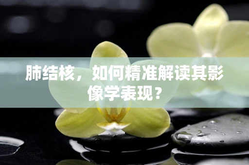 肺结核，如何精准解读其影像学表现？