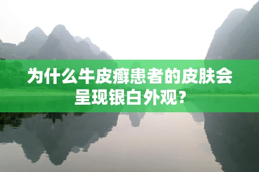 为什么牛皮癣患者的皮肤会呈现银白外观？