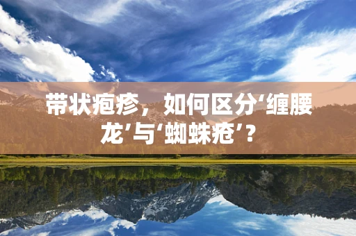 带状疱疹，如何区分‘缠腰龙’与‘蜘蛛疮’？
