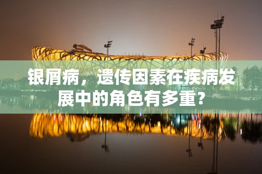 银屑病，遗传因素在疾病发展中的角色有多重？